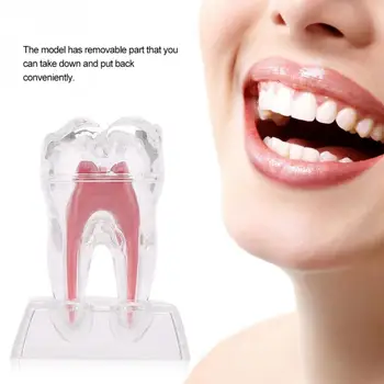 

Mini Size Comprehensive Dental Practice Teaching Model Transparent Nerve Removable Molar Tooth Dentist Equipment Oral Care Tools