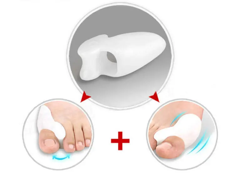MATAVENI 1Pair Gel Foot Care Tool Bunion Corrector Bone Big Toe Protector Hallux Valgus Straightener Toe Spreader Pedicure