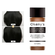 Средство для роста волос быстрее Сыворотка от выпадения волос поврежденный ремонт сущность волосы ремонт грубой для остановки выпадения волос анти-пролапс