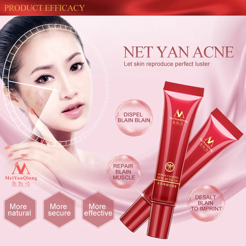 Herbal Face Anti acne Remove Repair treatment cream Herbal scar removal Quickly oily skin Quickly Acne 1 Herbal Face Anti acne Remove Repair treatment cream Herbal scar removal Quickly oily skin Quickly Acne 3