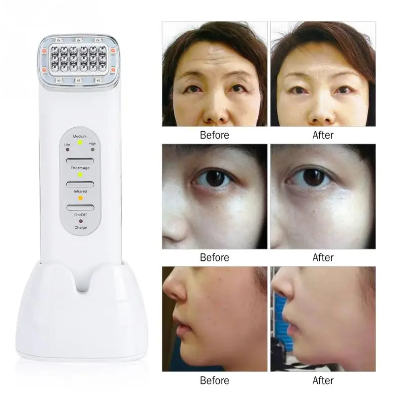 New RF Radio Frequency Far infrared Wave Therapy Skin Rejuvenation Face
