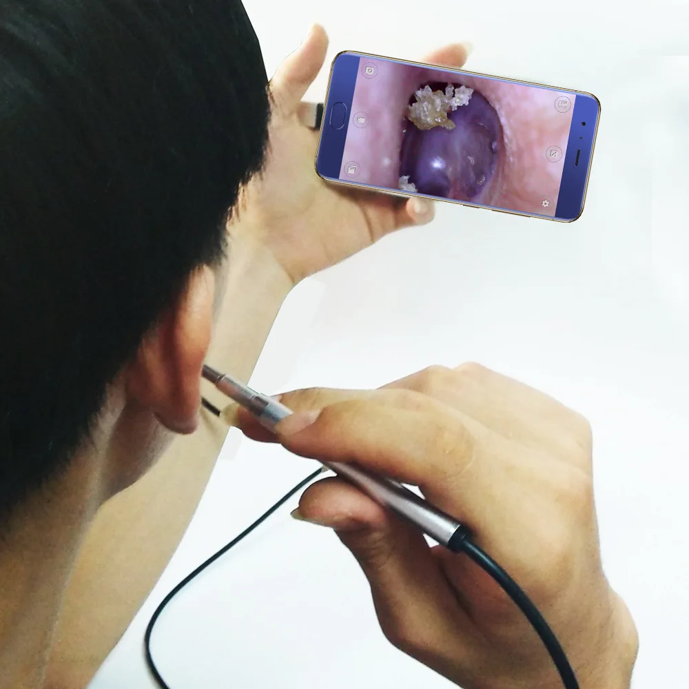 

CWH Ear Otoscope Multifunction Endoscopy 3.9mm Small Lens Visual Ear Spoon Ultra 3IN1 HD Ear Spoon Endoscope Camera