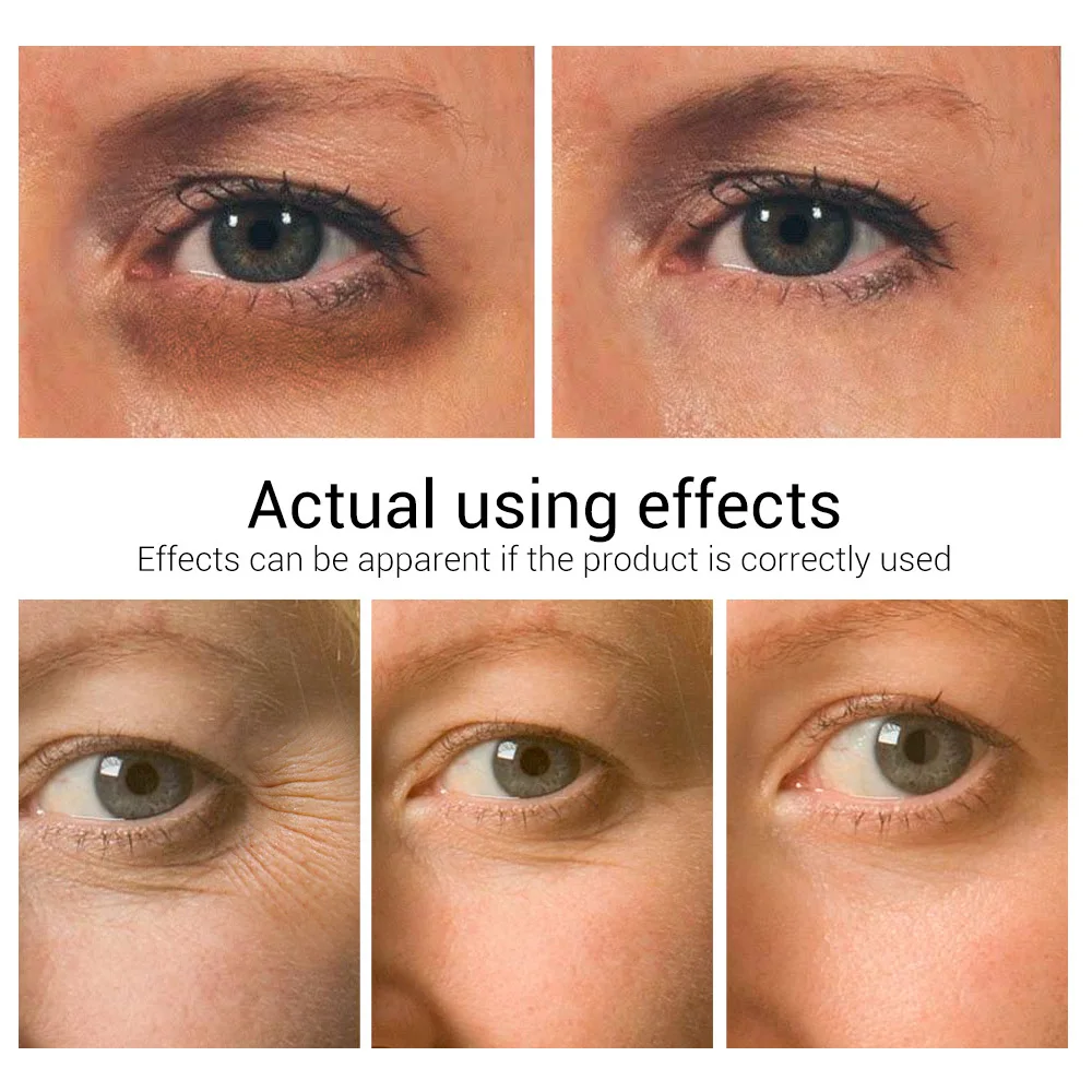 Lanbena Whitening Eye Cream Eye Serum Dark Circle Anti-aging Eye Patch Repair Ageless Lifting Firming Anti-puffiness Skin Care