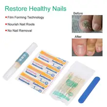 Лечение ногтей от грибка ручка травяная формула для серых ногтей Уход за ногами удаление грибка гель анти онихомикоз инфекция