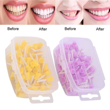 

100pcs/set Dental Polishing Rubber Polisher Cup Teeth Stain Removal Whitening Dentist Care Tool
