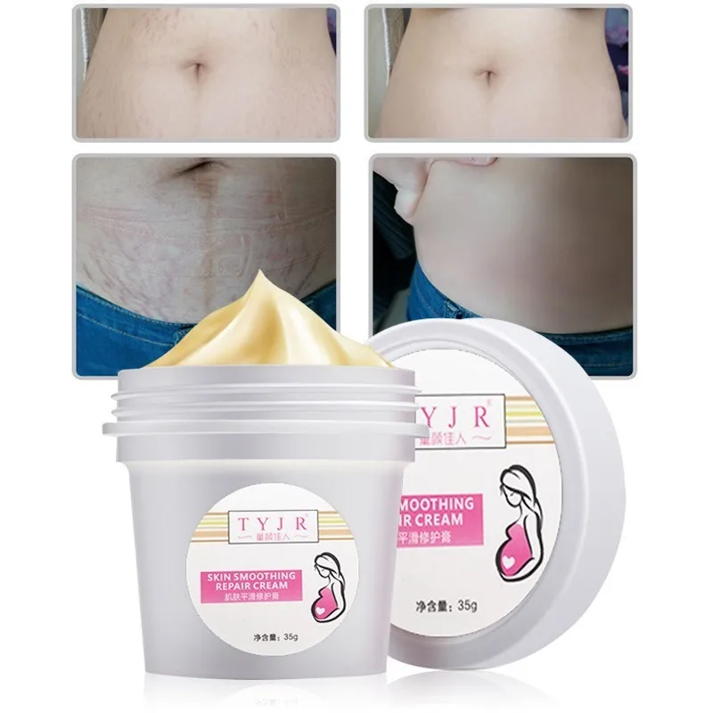 TYJR Stretch Marks Cream Remover Skin Repair Moisturizing Anti Wrinkles Firming Skin Pregnancy Cream Maternity Body Skin Care