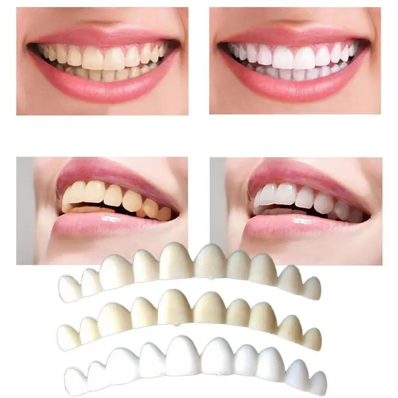 1pcs Natural Color Dental Veneers For Teeth False Smile Veneers