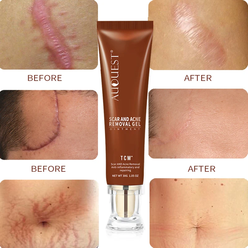 AUQUEST Face Cream Ginseng Extract Remove Acne Scars Repair Gel Red Spots Moisturizing Cream Stretch Marks Whitening Skin Care