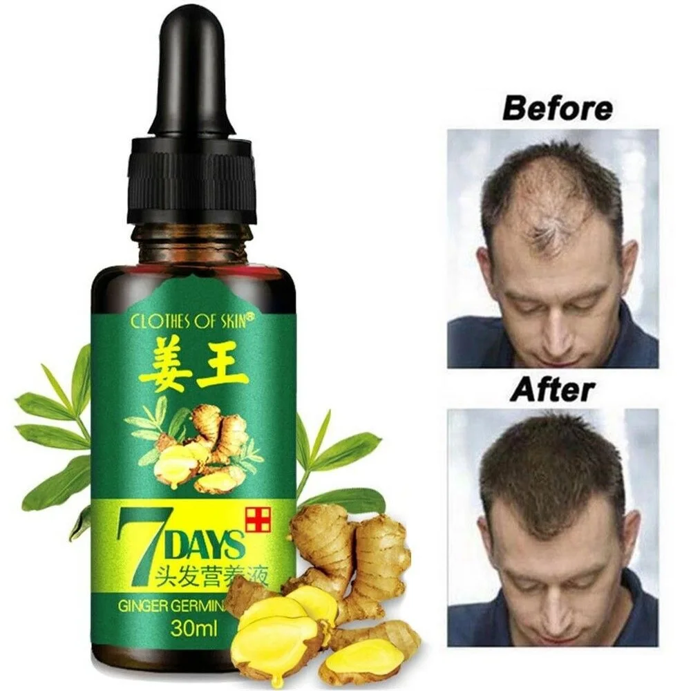 

30ml Hair Growth Serum Essence for Women Men Anti Preventing Hair Loss Alopecia Liquid Damaged Hair Repair Growing Faster
