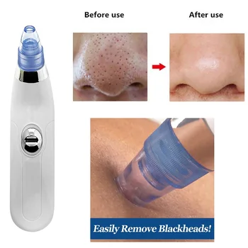 

Drop Ship 2019 Nose Blackhead Vacuum Remover Tool Pore Cleaner Electric Acne Clean Exfoliating Cleansing Suction Beauty Machine