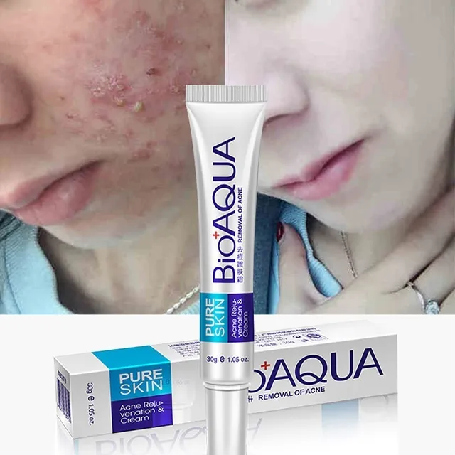 BIOAQUA Acne Face Cream Acne Remover Gel Anti Acne Cream On The Face