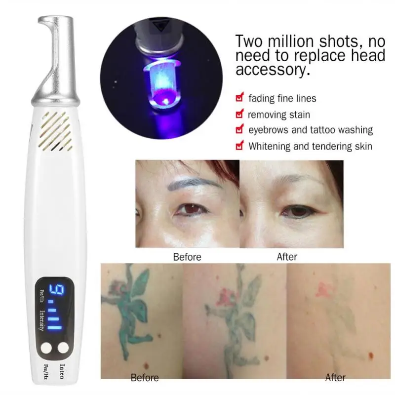 

Freckle Acne Mole Remover Pen Blu-ray Therapy Picosecond Laser Pen Facial Body Scar Dark Spot Tattoo Removal Anti Aging Machine