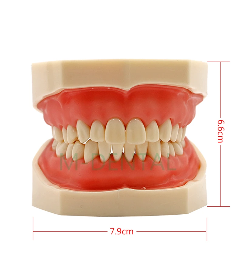 Стоматологический имплантат, модель зубов с реставрационным мостом, зубной Стоматолог для медицинских исследований