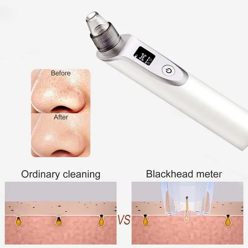 2 in 1 Baby Electric Nasal Aspirator Newborn Baby Nose Cleaner Adult Blackhead Remover 3 Speed Adjustable 5 Replaceable Tips