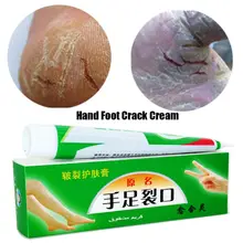 Health Hand Foot Crack Cream Heel Chapped Peeling Foot Hand Repair Anti Dry Crack Skin Ointment Cream Skin Care Moisturizing Health Hand Foot Crack Cream Heel Chapped Peeling Foot Hand Repair Anti Dry Crack Skin Ointment Cream Skin Care Moisturizing