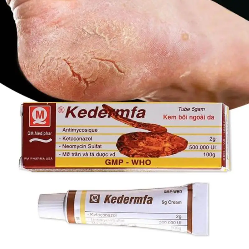 

Profession Snake Oil itching ointment Natural Herbal Powerful Anti Bacteria Cream Remove Scar Striae Gravidarum burn Skin L3