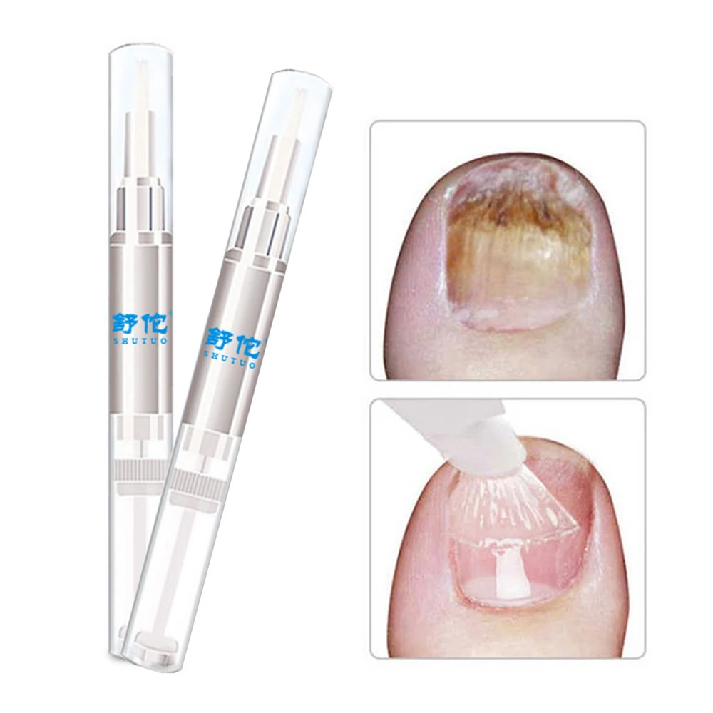 

Pro 1/3/5Pc 3ML Fungal Nail Treatment Pen Onychomycosis Paronychia Anti Fungal Nail Infection Nail Care Solution Toe Nail Fungus