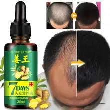 30ml Women Men Hair Care Nutrition Liquid Treatment Regrowth Hair Growth For Damaged Hair Essence Hair Lotion