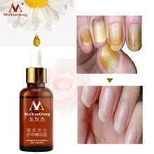 MeiYanQiong грибковое Лечение ногтей питательная осветляющая эссенция гель для удаления грибка ног анти-инфекция Paronychia onychomicosis