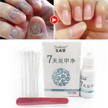 Лечение грибка для пальцев ног против грибковой инфекции ногтей желтая эссенция уход за чистыми грибок ногтей Лечение