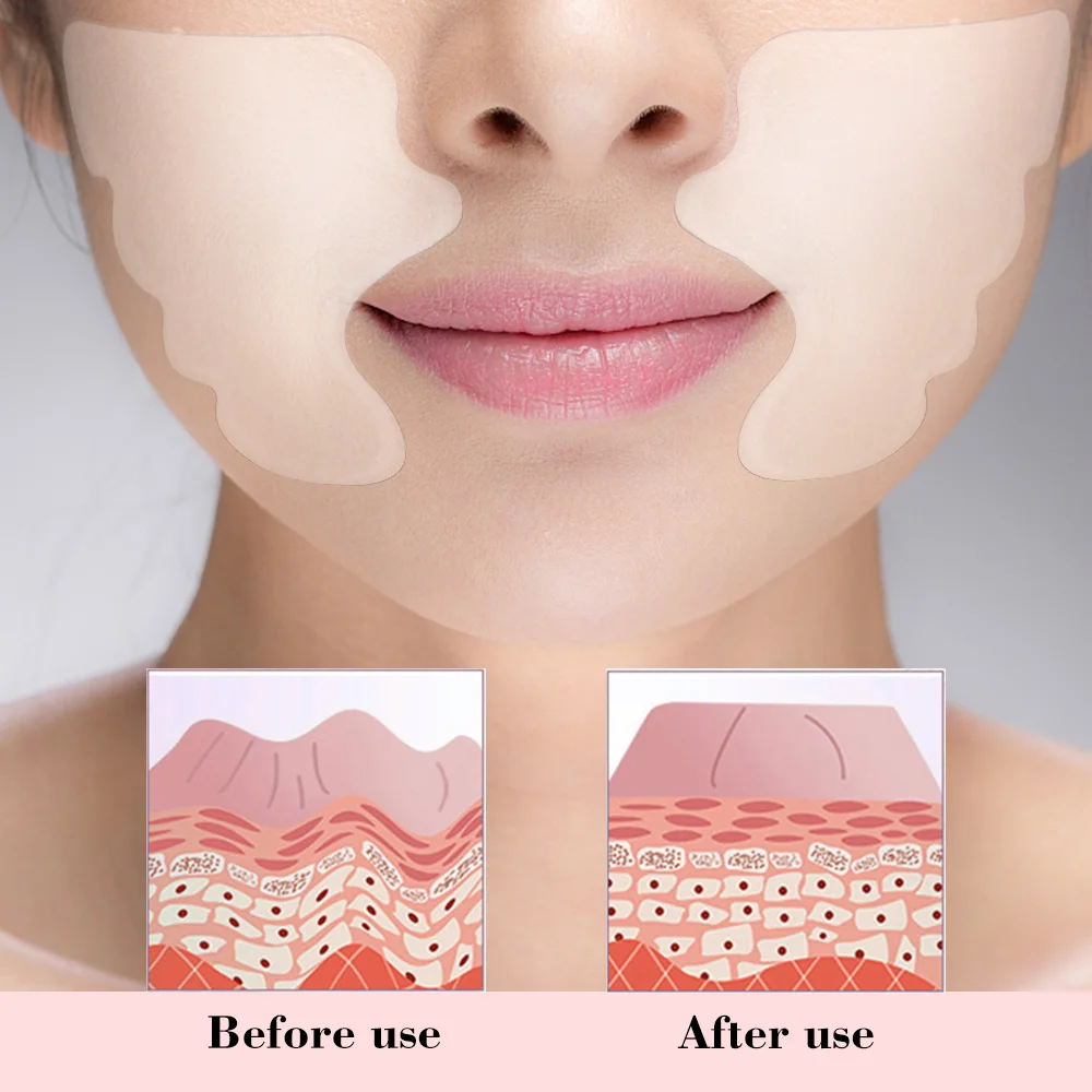 

Facial Lip Wrinkle Remover Pad Reusable Medical Grade Silicone Nasolabial Folds Anti-aging Mask Prevent Face Wrinkle