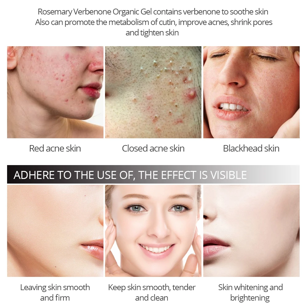 VIBRANT GLAMOUR Face Mask Blackhead Acne Remove Deep Cleaning Whitening Moisturizing Facial Mask Verbenone Rosemary Condensation 3