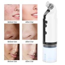 Удаление акне чёрных точек машина Вакуумный Очиститель пор пузырьки воздуха устройство красоты ac