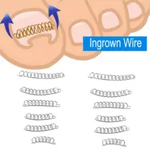 12 шт./кор. нейл-арта вросшие ногти вросших носком проволочный фиксатор для коррекции ногтей паронихии восстановить уход для педикюра, инструмент для ухода за ногами