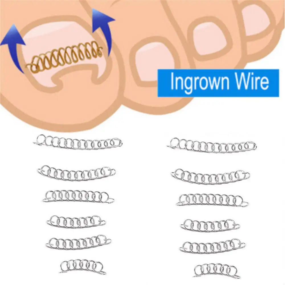 

12 Pcs/box Nail Art Ingrown Toenails Ingrown Toe Nail Correction Wire Fixer Paronychia Recover Care Pedicure Foot Care Tool