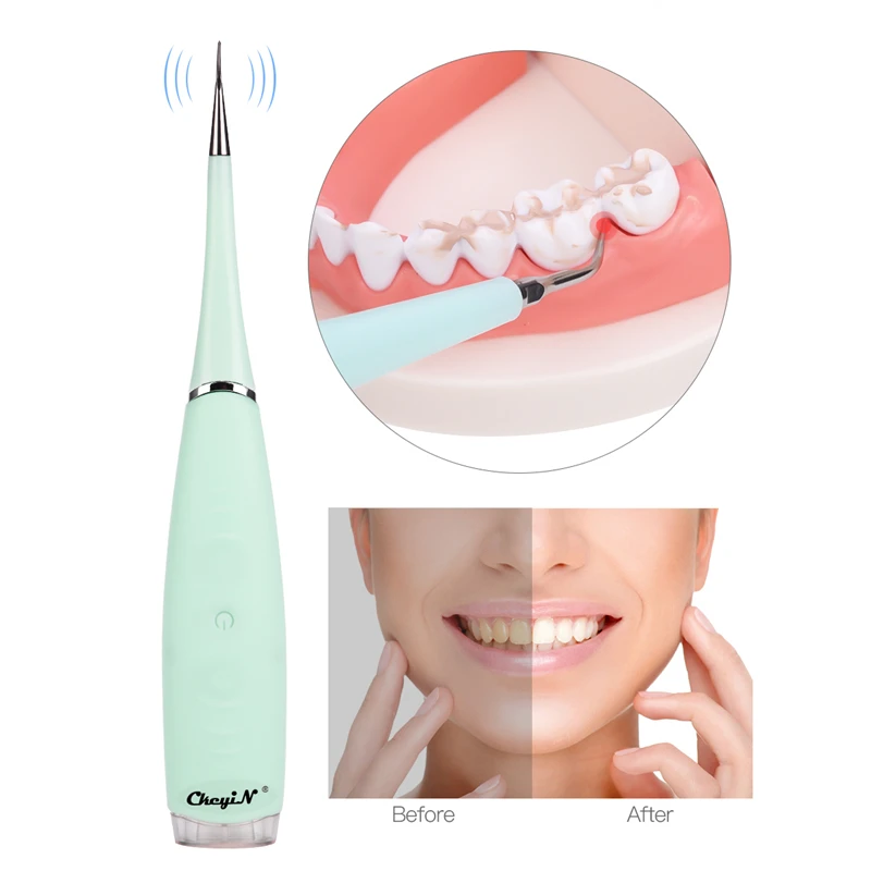 Electric Plaque Remover Alloy Steel Portable Toothpick Dental Tool Remove Dental Plaque Calculus Teeth Whitening Device Electric Plaque Remover Alloy Steel Portable Toothpick Dental Tool Remove Dental Plaque Calculus Teeth Whitening Device