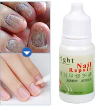 10 мл убивает онихомикоз анти грибок ногтей Лечение грибка крем штукатурка эссенция Уход за ногами отбеливание ног