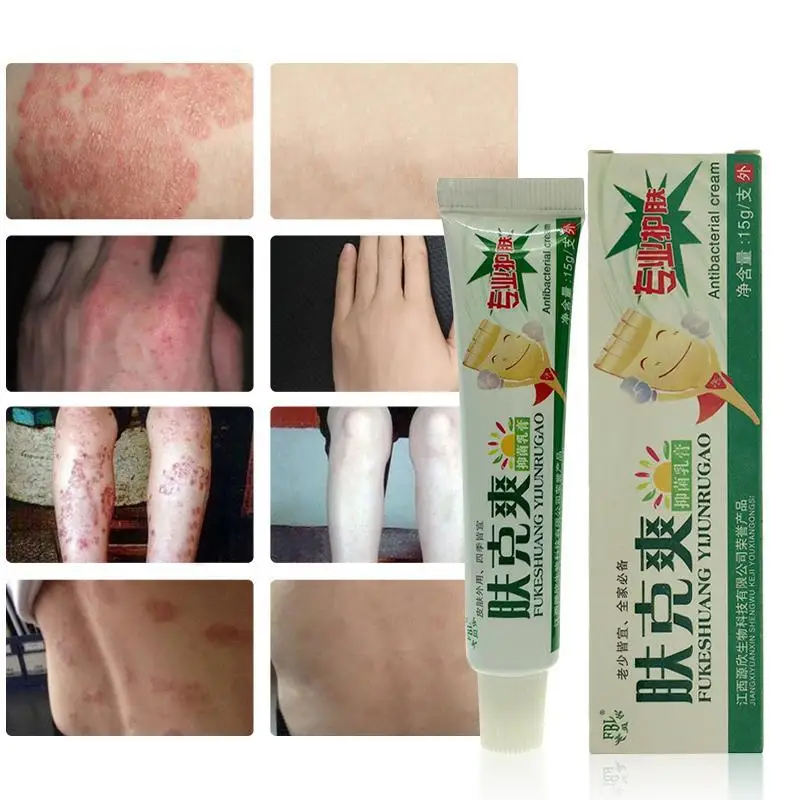 can you use eczema cream on psoriasis