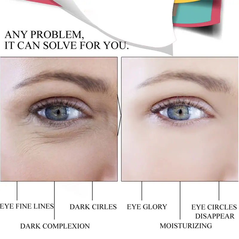 Anti Aging Herbal Probiotic Eye Cream Improve dark circle Intensely Hydrate Dry Skin Anti Puffines Reduce 4