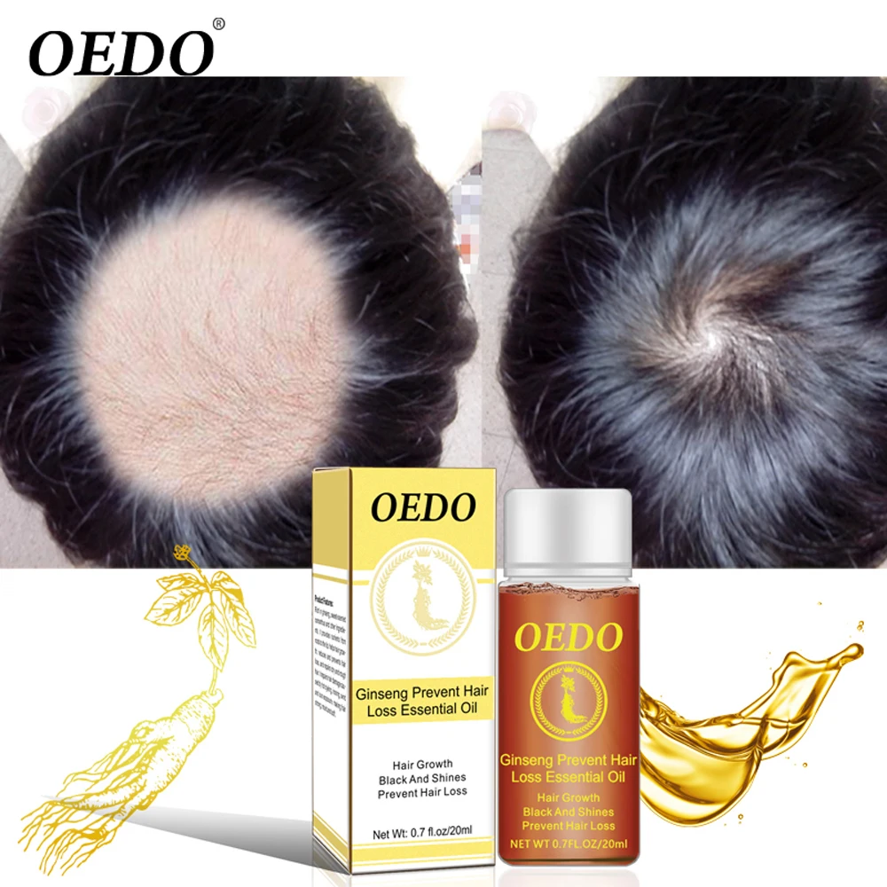 Ginseng Hair Growth Essence Anti Hair Loss Liquid 20ML Fast Restoration Dense Hair Growth Serum Powerful Repair Hair Root Ginseng Hair Growth Essence Anti Hair Loss Liquid 20ML Fast Restoration Dense Hair Growth Serum Powerful Repair Hair Root