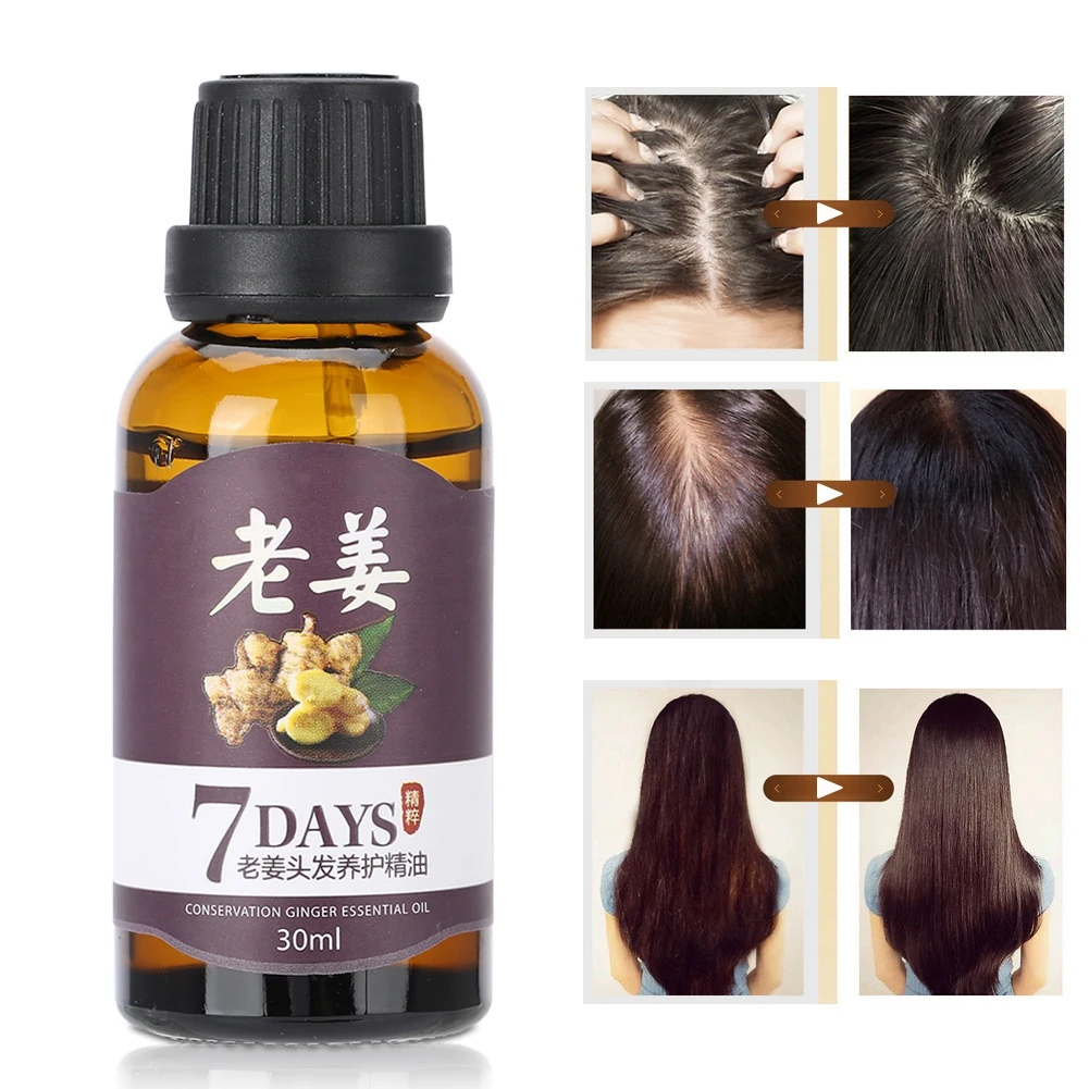 30ml Unisex Fast Hair Growth Essence Anti Loss Treatment Nourishing Natural Plant Extract Tool | Красота и здоровье