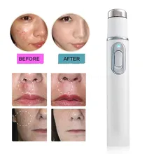 Прямая поставка 1 шт. медицинский синий свет лазерная терапия Лечение Акне ручка против морщин поры удаление устройства расслабляющий массаж уход за кожей