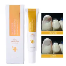 15 г травяной крем для ногтей Kill бактерии удаление грибка лечение онихомикоза ногтей ремонт СЕРЫЙ ЯРКИЙ Уход за ногтями педикюрный крем