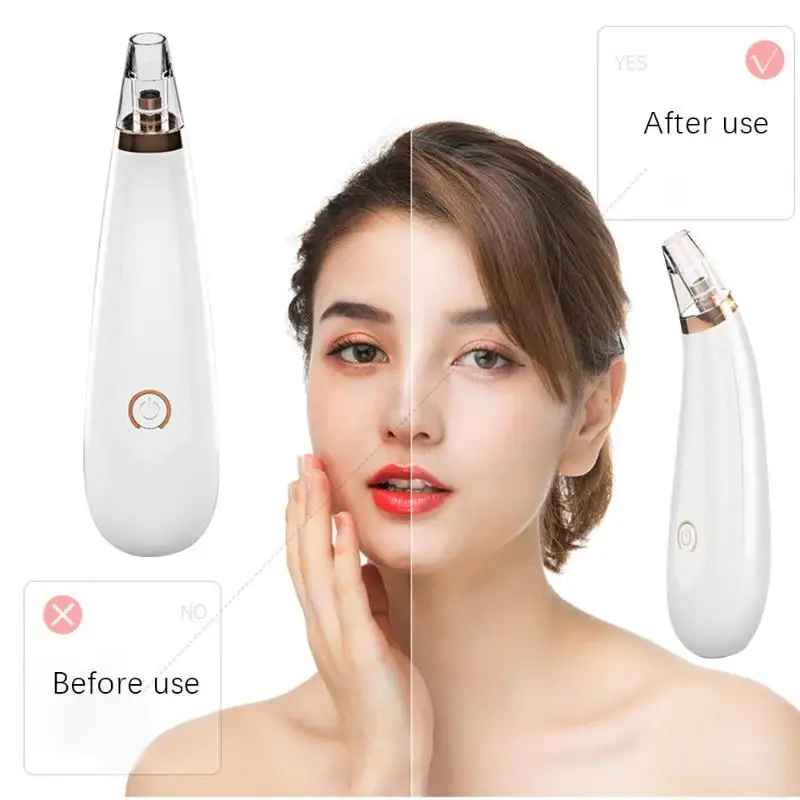 

Blackhead Skin Care Dropshipping Discounted Price Face Deep Pore Acne Pimple Removal Vacuum Suction Facial Diamond Beauty Tool