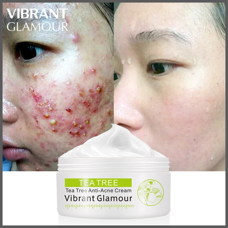VIBRANT GLAMOUR Tea Tree Anti-Acne Face Cream Acne Scar Cream Shrink Pores Facial Eliminates Acnes Cream Oil Control Repair Spot VIBRANT GLAMOUR Tea Tree Anti-Acne Face Cream Acne Scar Cream Shrink Pores Facial Eliminates Acnes Cream Oil Control Repair Spot