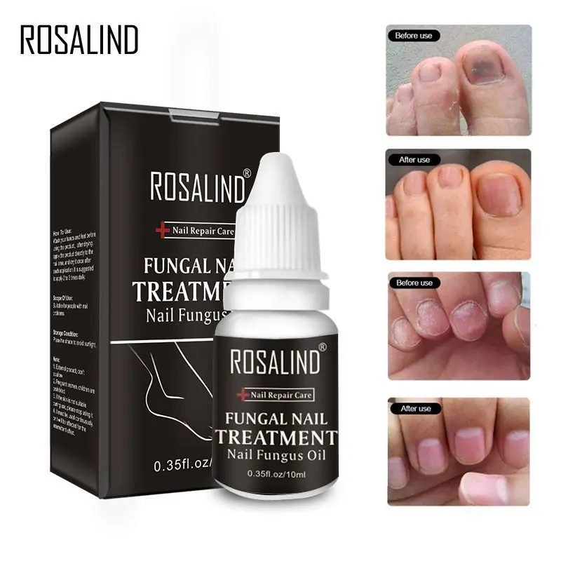 ROSALIND 10 мл Масло для кутикулы ног грибка лечения Ногтей противогрибковые средства