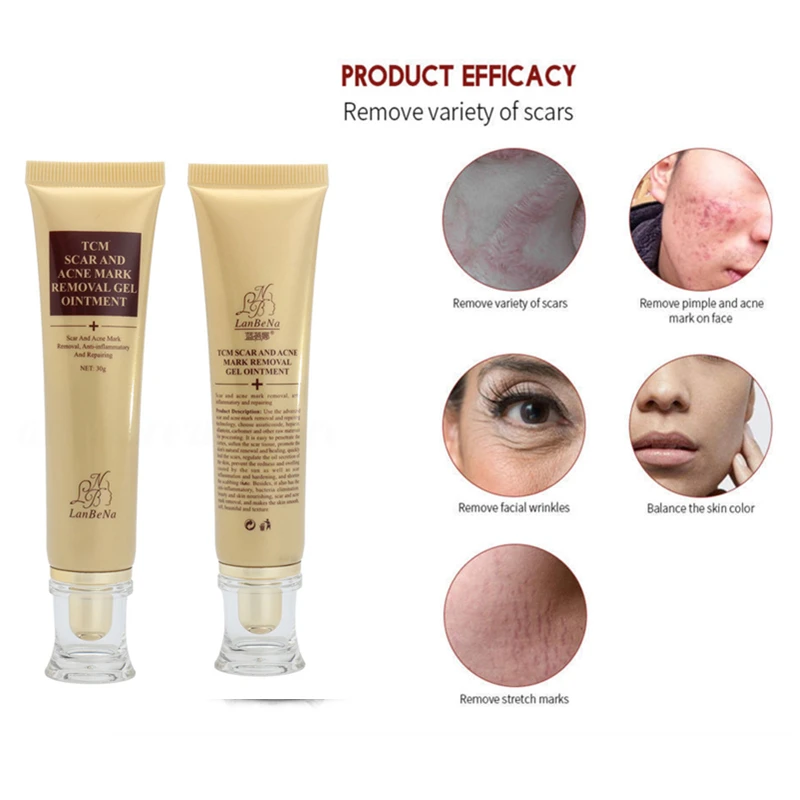 

30g Acne Scar Removal Cream for Face Skin Care Spots Acne Scar Treatment Stretch Marks Repair Whitening Pregnancy Cream TSLM2