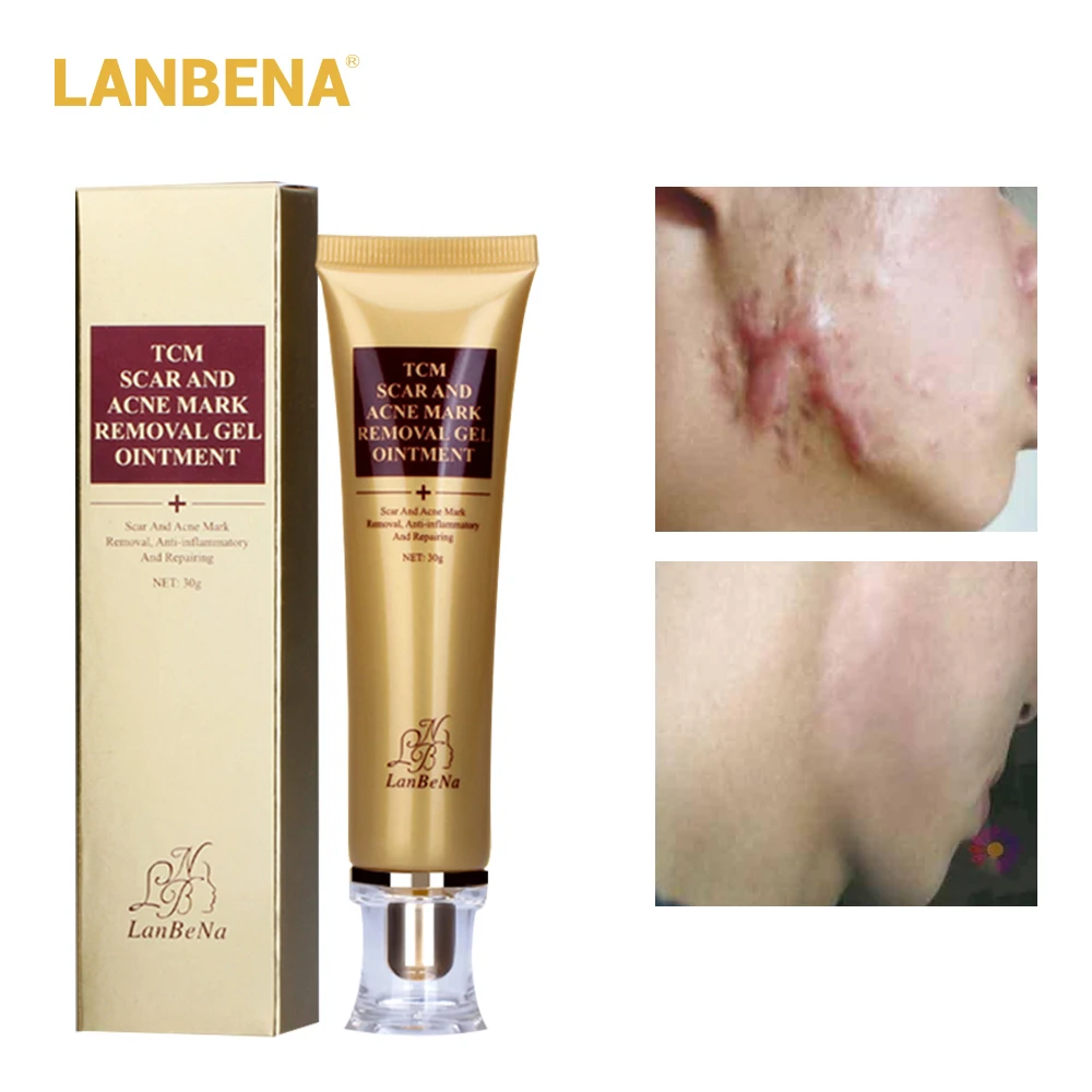 Buy 3 Get 1 Gift Lanbena Egf Remover Scar Cream Stretch Mark Gel Anti Acne Cream 3pcs +skin Repair Face Cream Acne Treatment