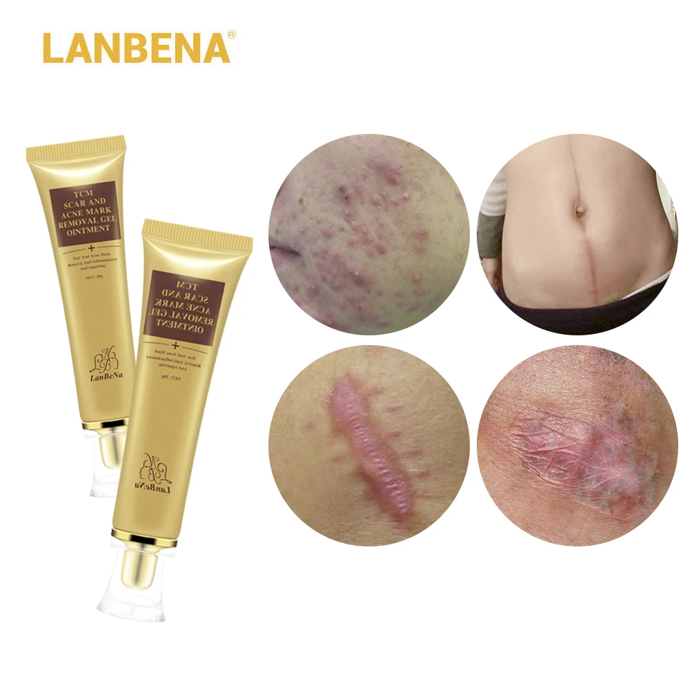 Lanbena Acne Scar Removal Cream Scar Gel Skin Repair Face Cream Acne Spots Acne Treatment Skin Care Whitening Stretch Marks 2pcs