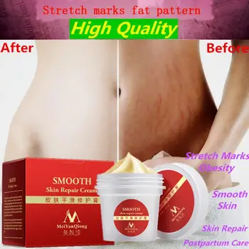 

Skin Repair Cream Skin Care Scar Oil Stretchmarks Repair Oil Whitening Remover Smooth Luster Soft Moisturizing Bright 35g #509