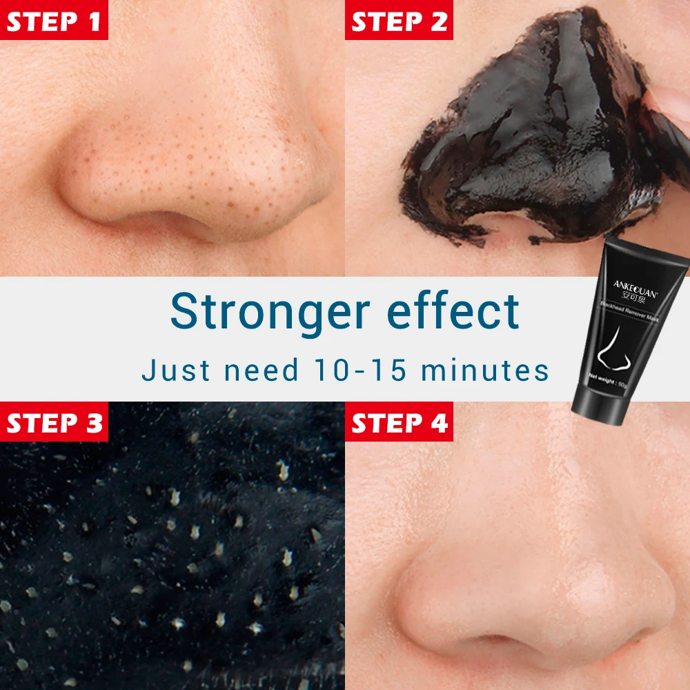 AUQUEST Hyaluronic Acid  Blackhead Face Cream Acne Treatment Mask Deep Cleaning Shrink Pores Oil Control Whitening Skin Care
