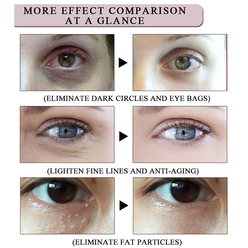 Anti Aging Herbal Probiotic Eye Cream Improve dark circle Intensely Hydrate Dry Skin Anti Puffines Reduce 3