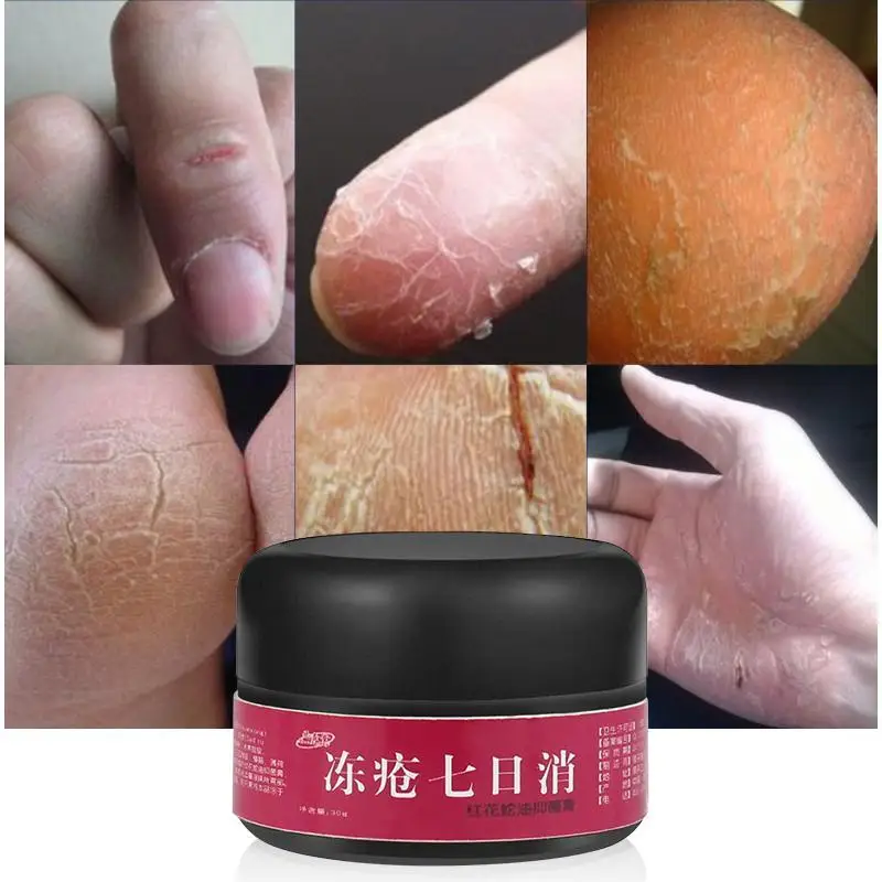 30g Hand Foot Crack Cream Heel Chapped Peeling Repair Anti Dry Skin Ointment L3 |