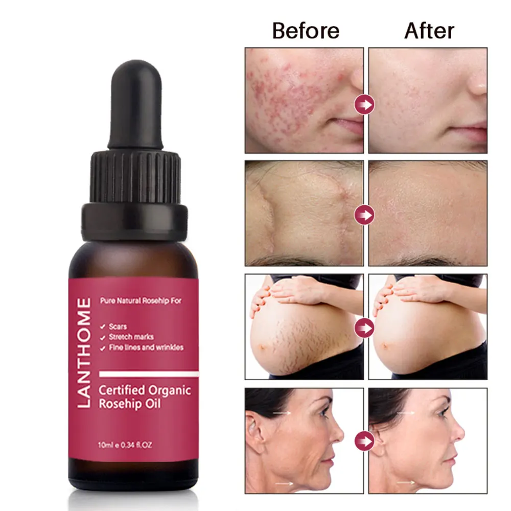 

Face Hyaluronic Acid Serum Essential Oil Anti-Aging Anti-Wrinkle Skin Care Moisturizing Essence Shrink Pores Whitening Plant