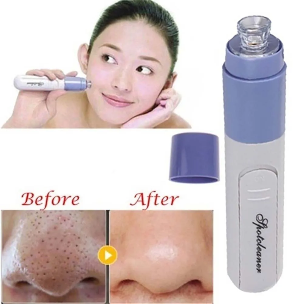 

1 PC Facial Acne Blackhead Removal Tool Kit Mini Electric Skin Cleaner Face Dirt Suck Up Vacuum Face Clean Pore Cleaner Tool