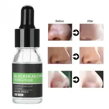 10 мл усадка эссенция экспорт жидкость Удаление угрей набор глубокое очищение